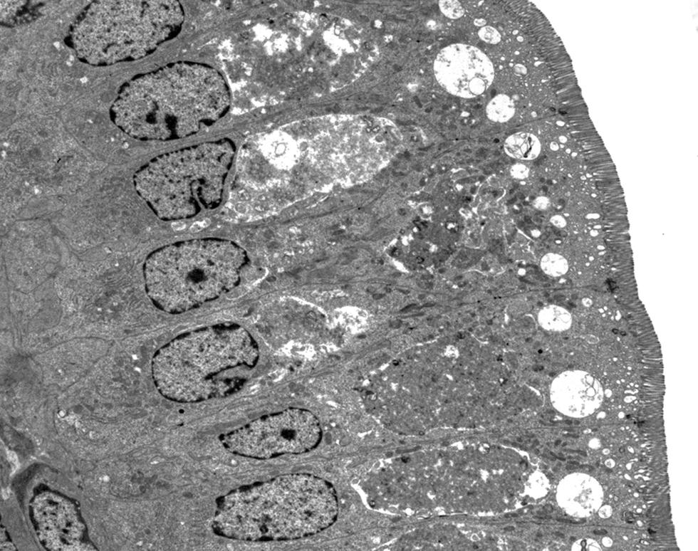 Intestinal mucosa